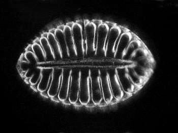 [diatoms diatom image images diatomeen fotos]
