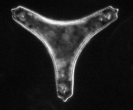 [diatoms diatom image images diatomeen fotos]