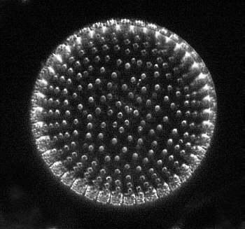 [diatoms diatom image images diatomeen fotos]